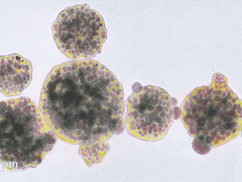 Pomegranate particles