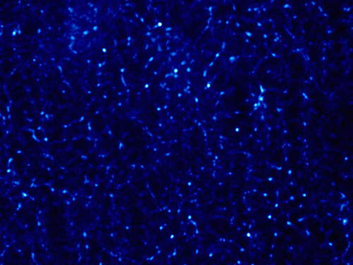 Polystyrene Latex Droplets Deposited on Human Respiratory Cells