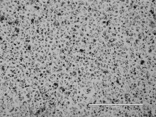 Paisley Patterned Lung Cells