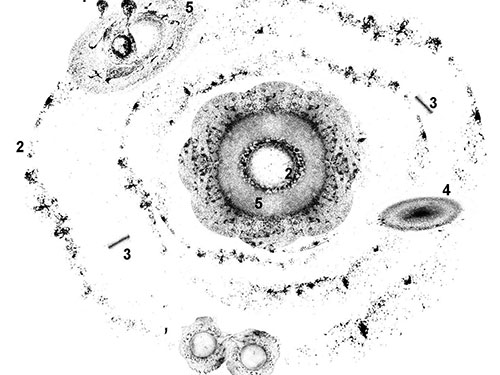 The Universe of CuONPs (on Lung Cells)