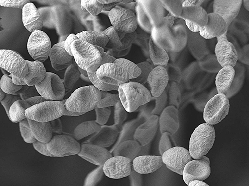 Biosensors: A Smart Approach Towards Clinical Diagnostics And Healthier Environment