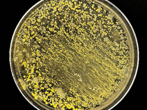 A Chicken Coop's Microbial Signature